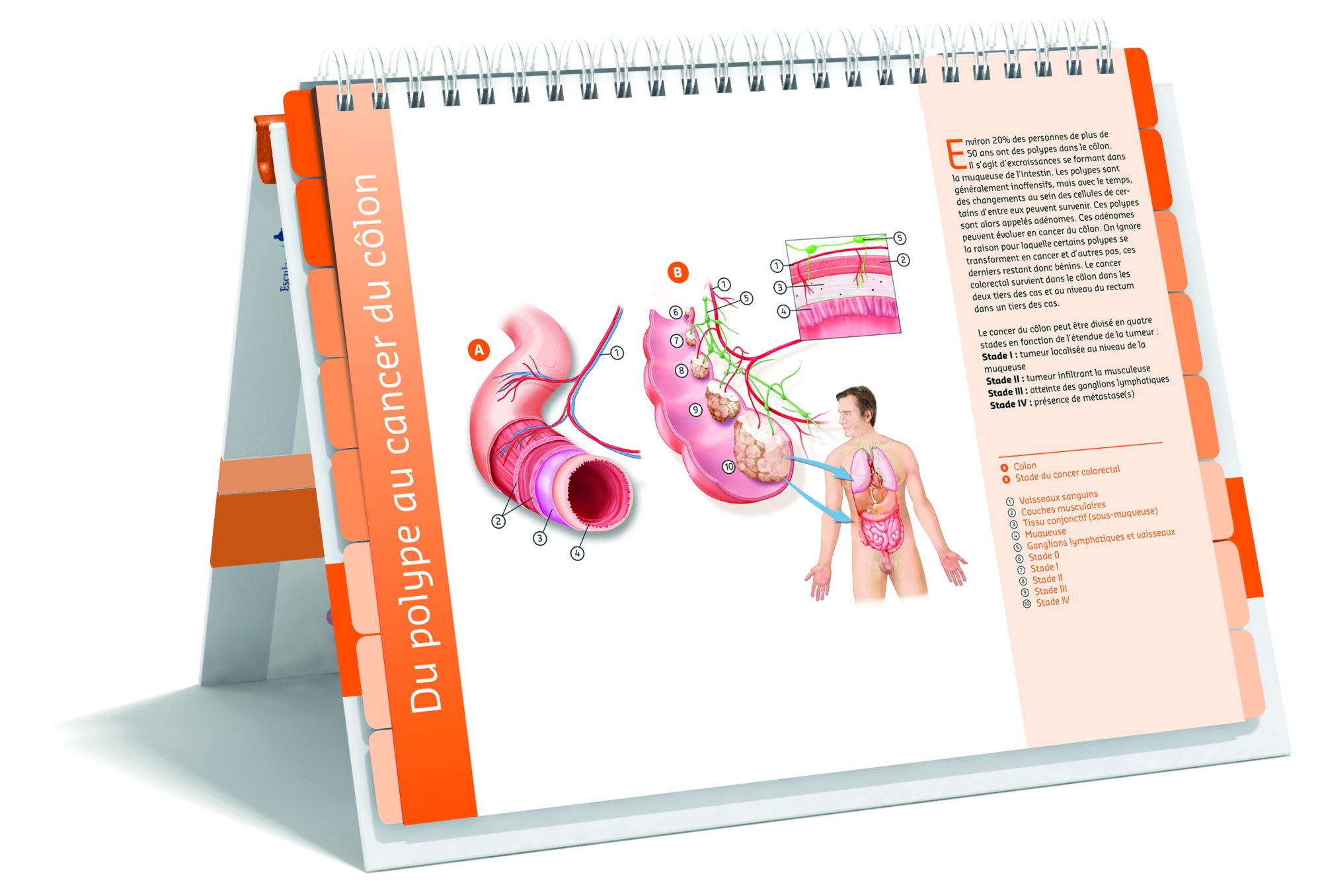 Zorgatlas Dikkedarm En Endeldarmkanker FR